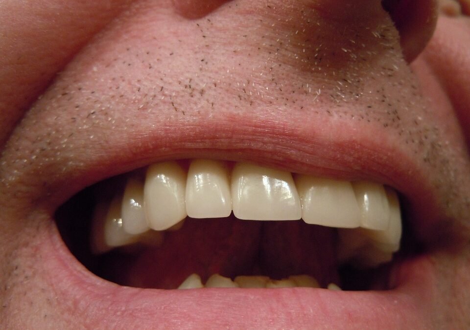 Watch Your Mouth: Decoding the Language of Unconscious Bias at Work